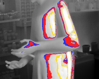 St_Anthony_pulse_thermograpy